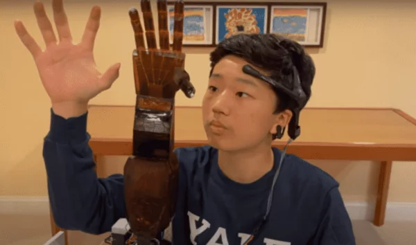 A high school student built a prosthetic arm he controls with his mind. Using AI?